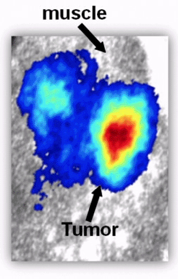 Imagen: La tecnología CLI demuestra la presencia de un tumor (Fotografía cortesía de Zhen Cheng, PhD). Imagen: La tecnología CLI demuestra la presencia de un tumor (Fotografía cortesía de Zhen Cheng, PhD).